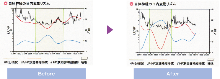 プレゼンティーイズムイメージ